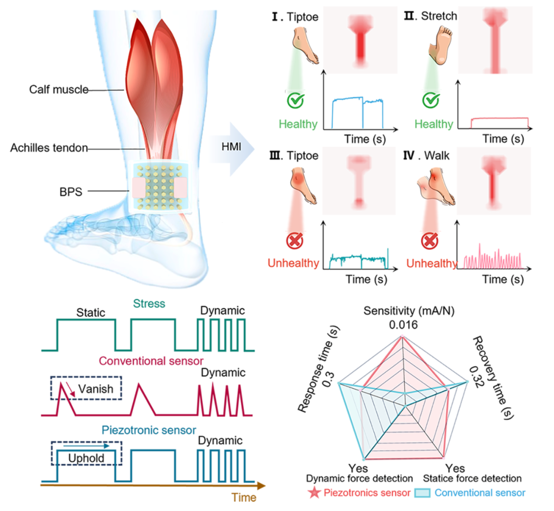 西南交大Nano-Micro Letters——用于跟腱行为检测的双模态压电电子学传感器